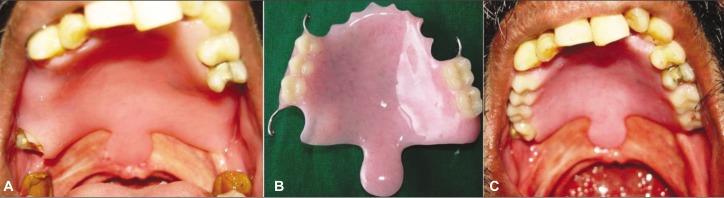 https://cdn.ncbi.nlm.nih.gov/pmc/blobs/0346/3517964/d7e5e7e54679/jap-4-243-g002.jpg