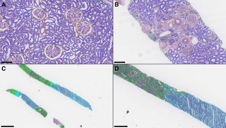 https://cdn.ncbi.nlm.nih.gov/pmc/blobs/0349/10758512/35f6cbeacd78/kidney360-4-1726-g002.jpg