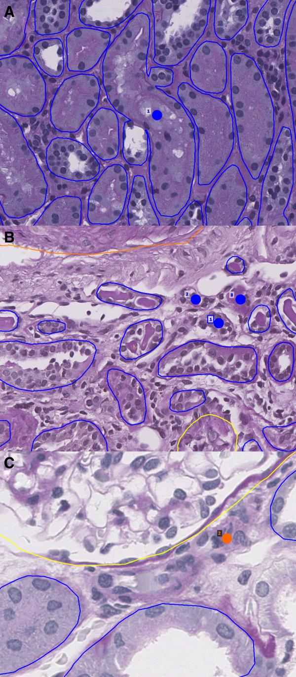 https://cdn.ncbi.nlm.nih.gov/pmc/blobs/0349/10758512/ededd5c9ee3b/kidney360-4-1726-g003.jpg