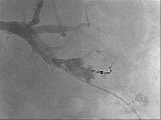 https://cdn.ncbi.nlm.nih.gov/pmc/blobs/0349/6857264/1783c489ce51/IJRI-29-310-g002.jpg