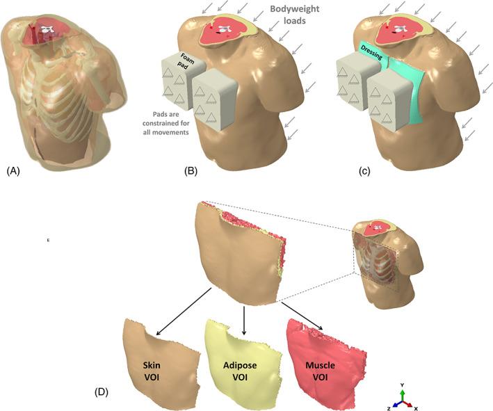 https://cdn.ncbi.nlm.nih.gov/pmc/blobs/034c/9615289/05f80348ae57/IWJ-19-1786-g002.jpg