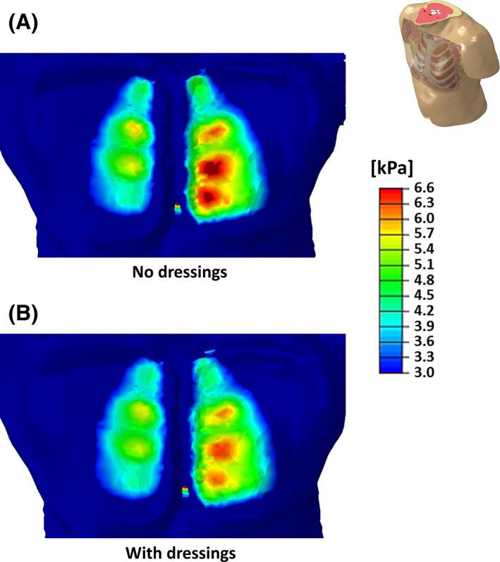 https://cdn.ncbi.nlm.nih.gov/pmc/blobs/034c/9615289/295c7ad45671/IWJ-19-1786-g004.jpg