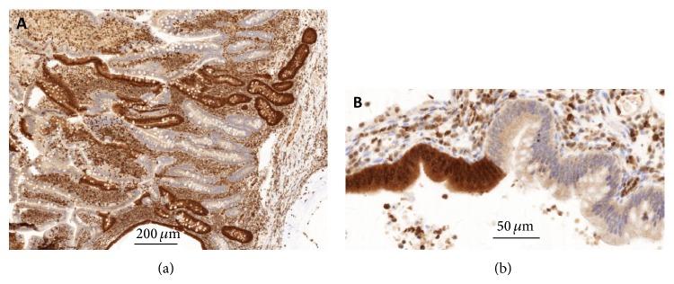https://cdn.ncbi.nlm.nih.gov/pmc/blobs/034f/4331480/1f0aeb4022e8/CRIGM2015-140616.004.jpg