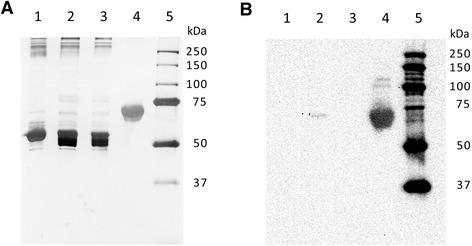 https://cdn.ncbi.nlm.nih.gov/pmc/blobs/0351/4212105/0bfdafce7aa1/12917_2014_251_Fig2_HTML.jpg