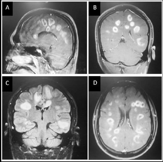 https://cdn.ncbi.nlm.nih.gov/pmc/blobs/0351/6290221/75d08ac1d998/PJMS-34-1579-g001.jpg