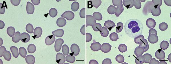 https://cdn.ncbi.nlm.nih.gov/pmc/blobs/0355/9328922/e045969d137f/21-2425-F2.jpg