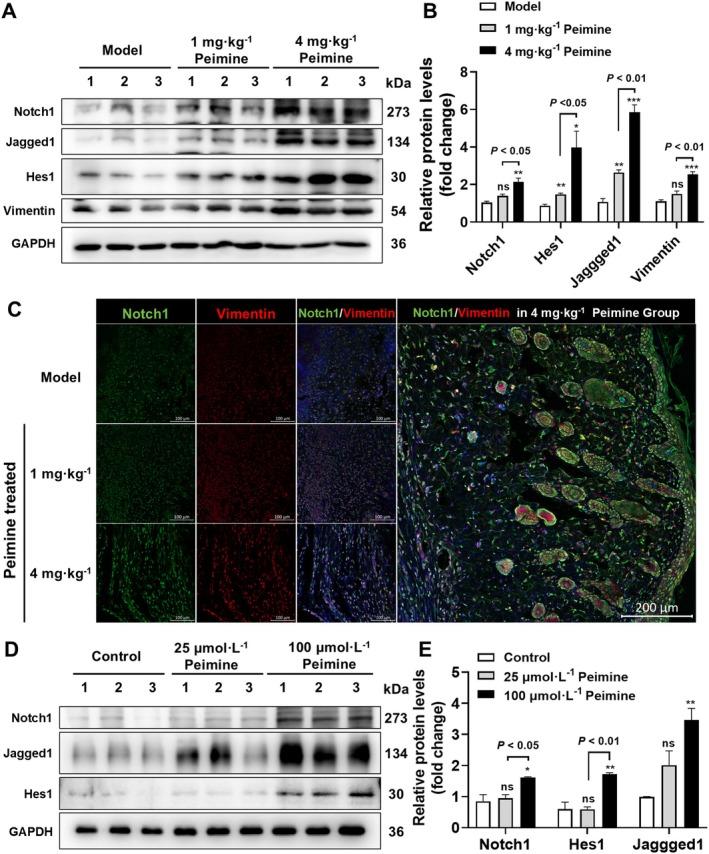 https://cdn.ncbi.nlm.nih.gov/pmc/blobs/0356/12146499/5af5f4057238/FSN3-13-e70406-g001.jpg