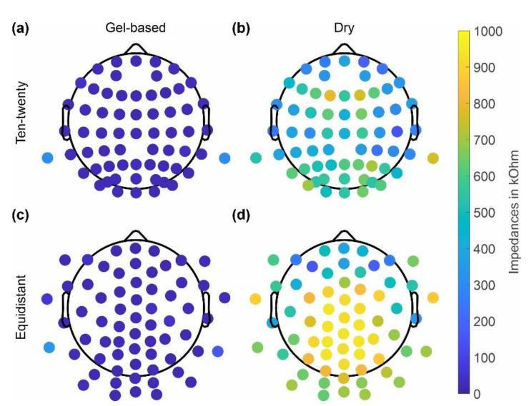 https://cdn.ncbi.nlm.nih.gov/pmc/blobs/0356/9612204/1f81855a878d/sensors-22-08079-g003.jpg