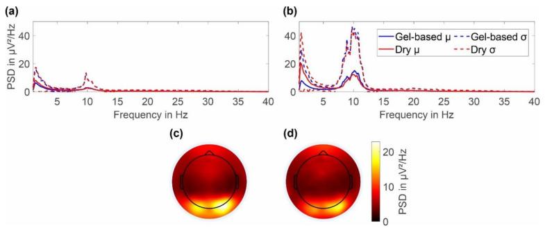 https://cdn.ncbi.nlm.nih.gov/pmc/blobs/0356/9612204/72479d171be2/sensors-22-08079-g007.jpg