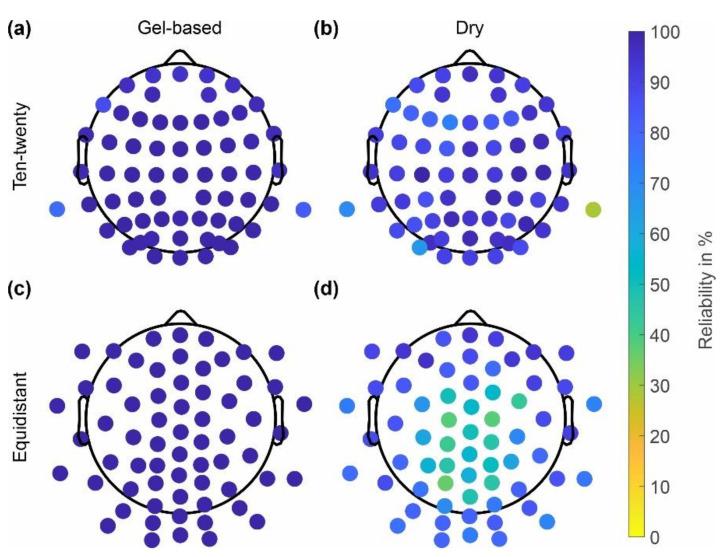 https://cdn.ncbi.nlm.nih.gov/pmc/blobs/0356/9612204/9e8fc5afacef/sensors-22-08079-g004.jpg