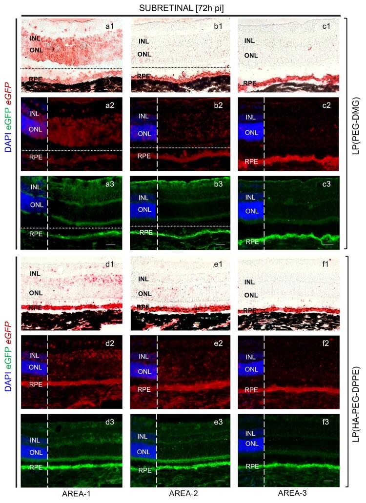 https://cdn.ncbi.nlm.nih.gov/pmc/blobs/0359/12351706/02f02587824d/IDRD_A_2544688_F0006_C.jpg