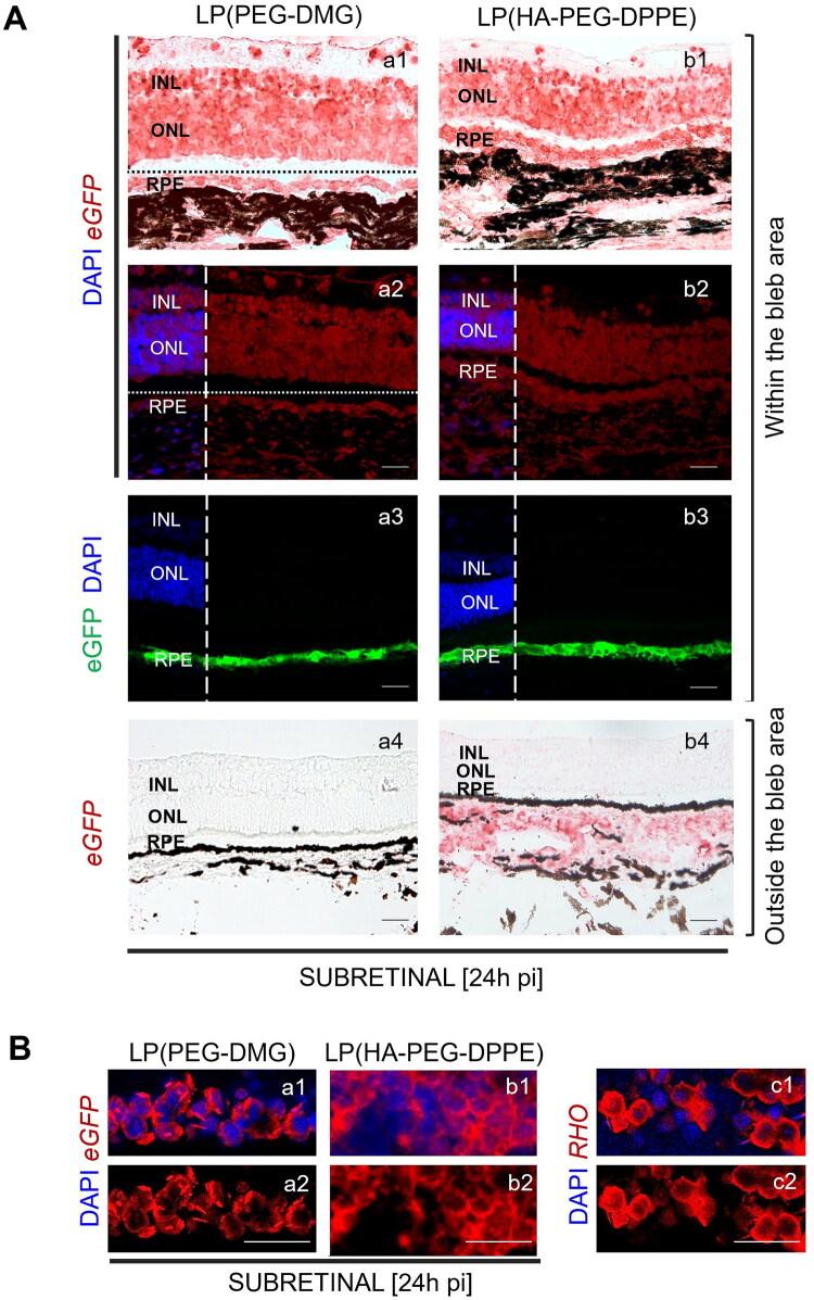 https://cdn.ncbi.nlm.nih.gov/pmc/blobs/0359/12351706/1a2fb245cabb/IDRD_A_2544688_F0004_C.jpg