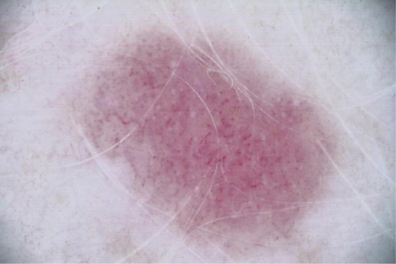 https://cdn.ncbi.nlm.nih.gov/pmc/blobs/035c/5315039/ceca035285d5/dp0701a07g003.jpg