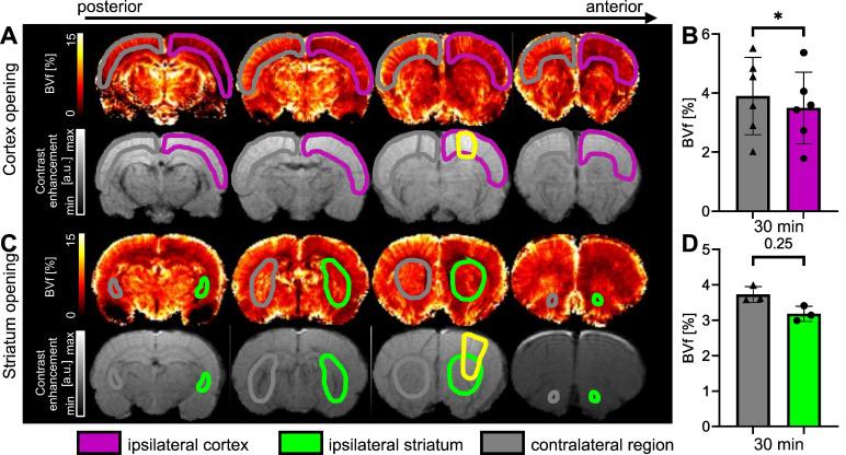 https://cdn.ncbi.nlm.nih.gov/pmc/blobs/035f/11234282/b727f9d20f0f/thnov14p4147g008.jpg