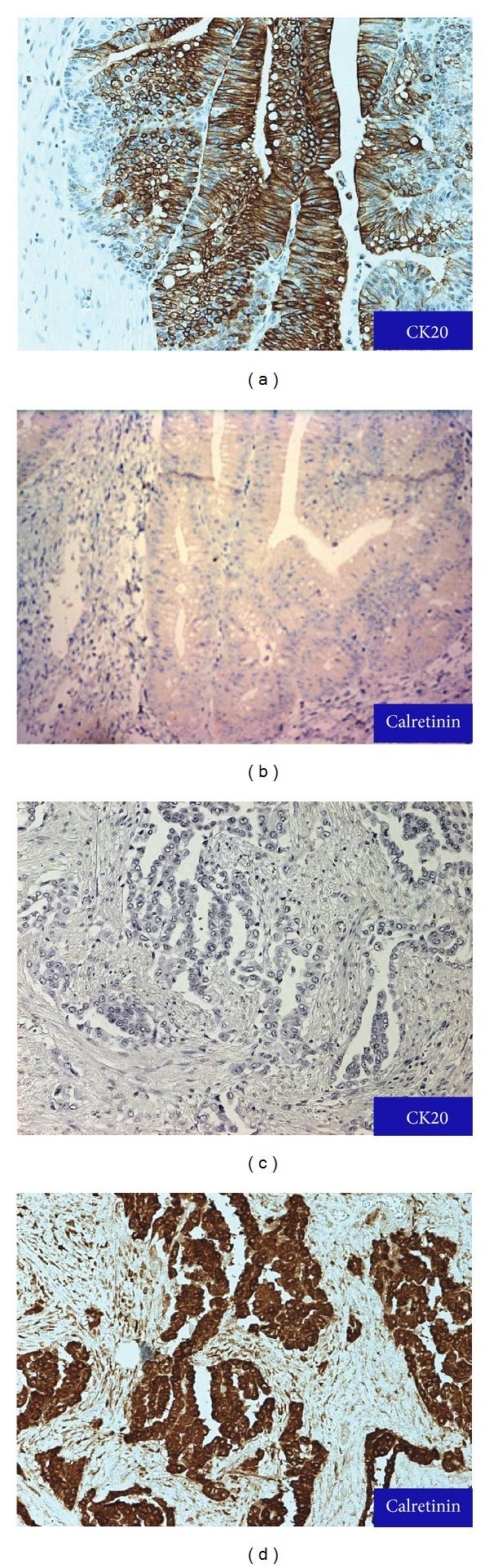https://cdn.ncbi.nlm.nih.gov/pmc/blobs/0363/4055023/3f57bd9a8a63/CRIPA2014-838506.003.jpg