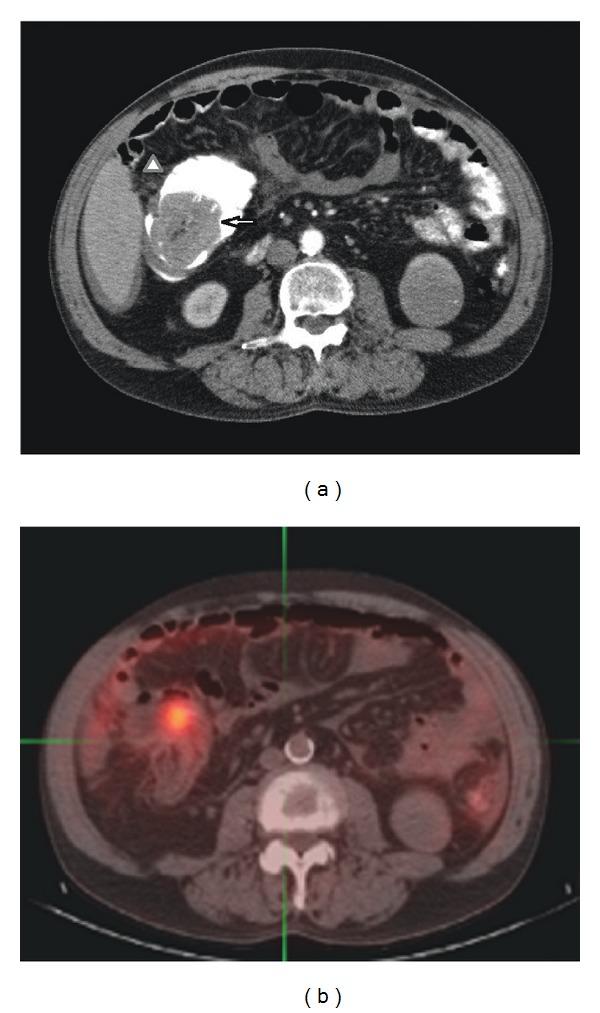 https://cdn.ncbi.nlm.nih.gov/pmc/blobs/0363/4055023/71bedea3018f/CRIPA2014-838506.001.jpg
