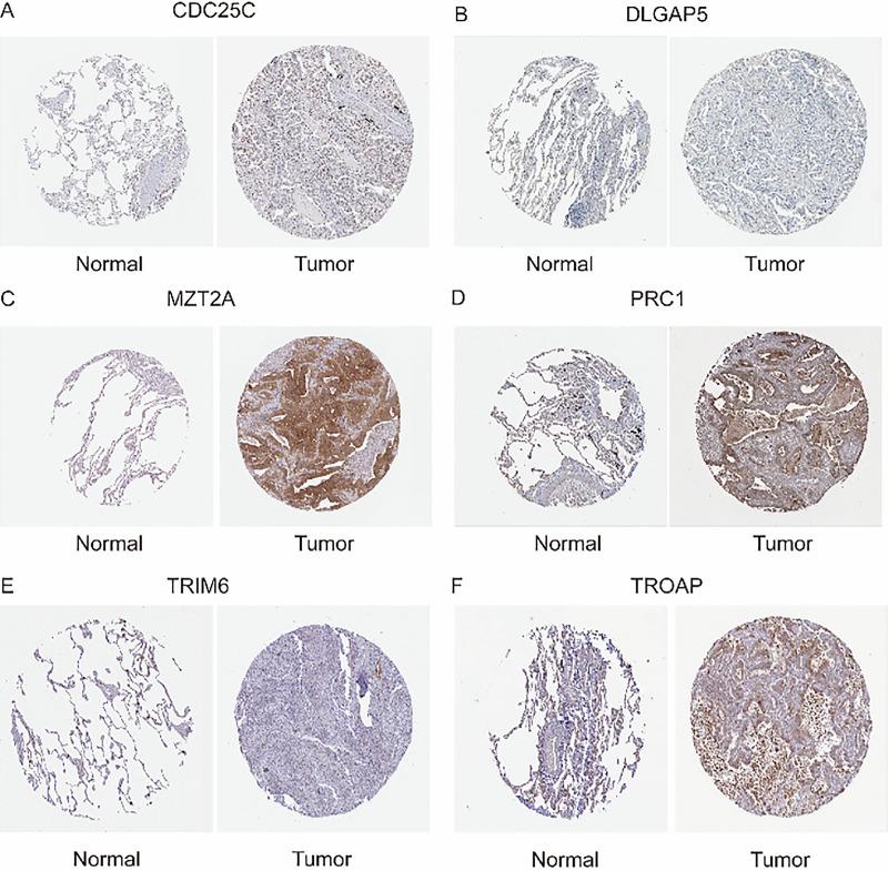 https://cdn.ncbi.nlm.nih.gov/pmc/blobs/0364/12215551/710f34e99d35/OncolRes-33-56176-f011.jpg
