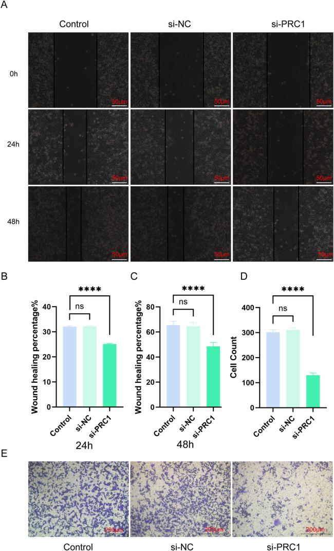 https://cdn.ncbi.nlm.nih.gov/pmc/blobs/0364/12215551/e1db60a176f8/OncolRes-33-56176-f013.jpg