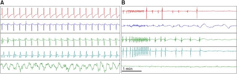 https://cdn.ncbi.nlm.nih.gov/pmc/blobs/036d/3548127/2280f398a731/jnm-19-5-g003.jpg