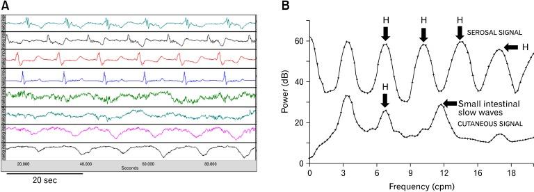 https://cdn.ncbi.nlm.nih.gov/pmc/blobs/036d/3548127/b6534be732c7/jnm-19-5-g007.jpg
