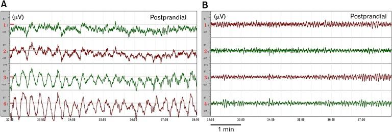 https://cdn.ncbi.nlm.nih.gov/pmc/blobs/036d/3548127/ea215e51b596/jnm-19-5-g005.jpg