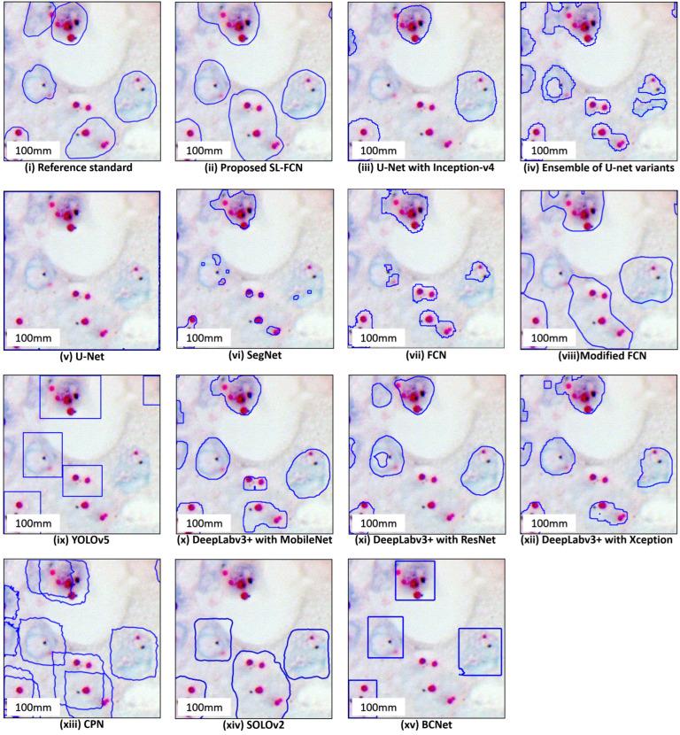 https://cdn.ncbi.nlm.nih.gov/pmc/blobs/0372/9657740/e1103422a74f/cancers-14-05312-g004.jpg