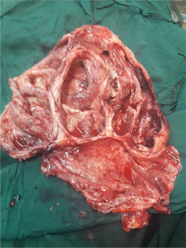 https://cdn.ncbi.nlm.nih.gov/pmc/blobs/0379/5960236/afcd29559cc7/imcrj-11-113Fig1.jpg