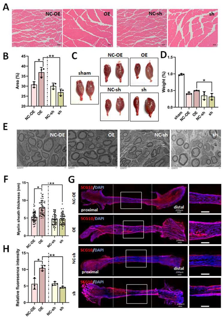 https://cdn.ncbi.nlm.nih.gov/pmc/blobs/037b/12024759/8353155ede50/biomedicines-13-00872-g006.jpg