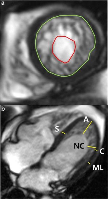 https://cdn.ncbi.nlm.nih.gov/pmc/blobs/0381/4855408/433309db9006/12968_2016_245_Fig1_HTML.jpg