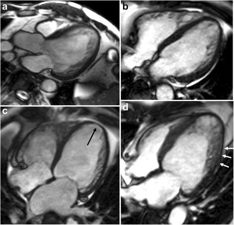 https://cdn.ncbi.nlm.nih.gov/pmc/blobs/0381/4855408/95eb26182c69/12968_2016_245_Fig3_HTML.jpg