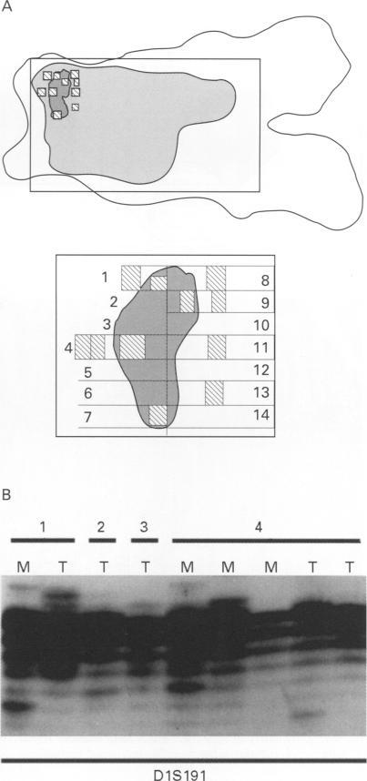 https://cdn.ncbi.nlm.nih.gov/pmc/blobs/0381/500266/a07034e9cf0b/jclinpath00259-0045-b.jpg