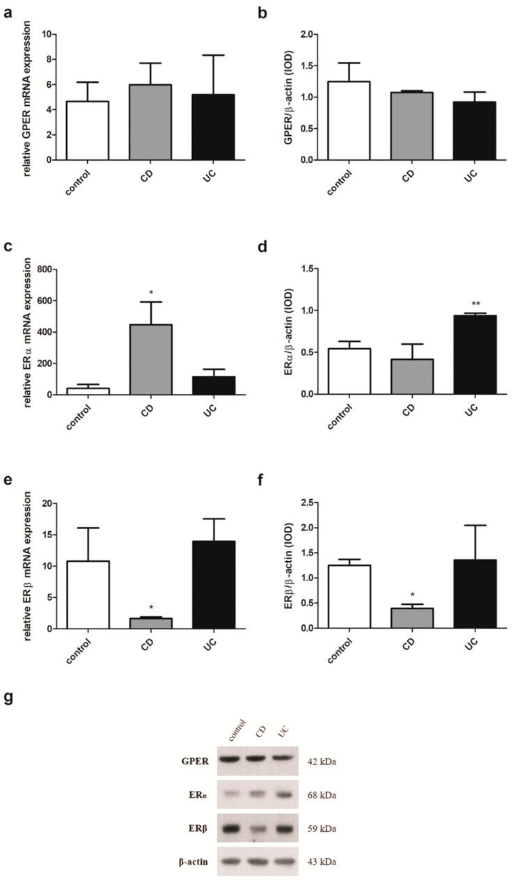 https://cdn.ncbi.nlm.nih.gov/pmc/blobs/038e/6651503/777bd62f6f14/ijms-20-03175-g006.jpg