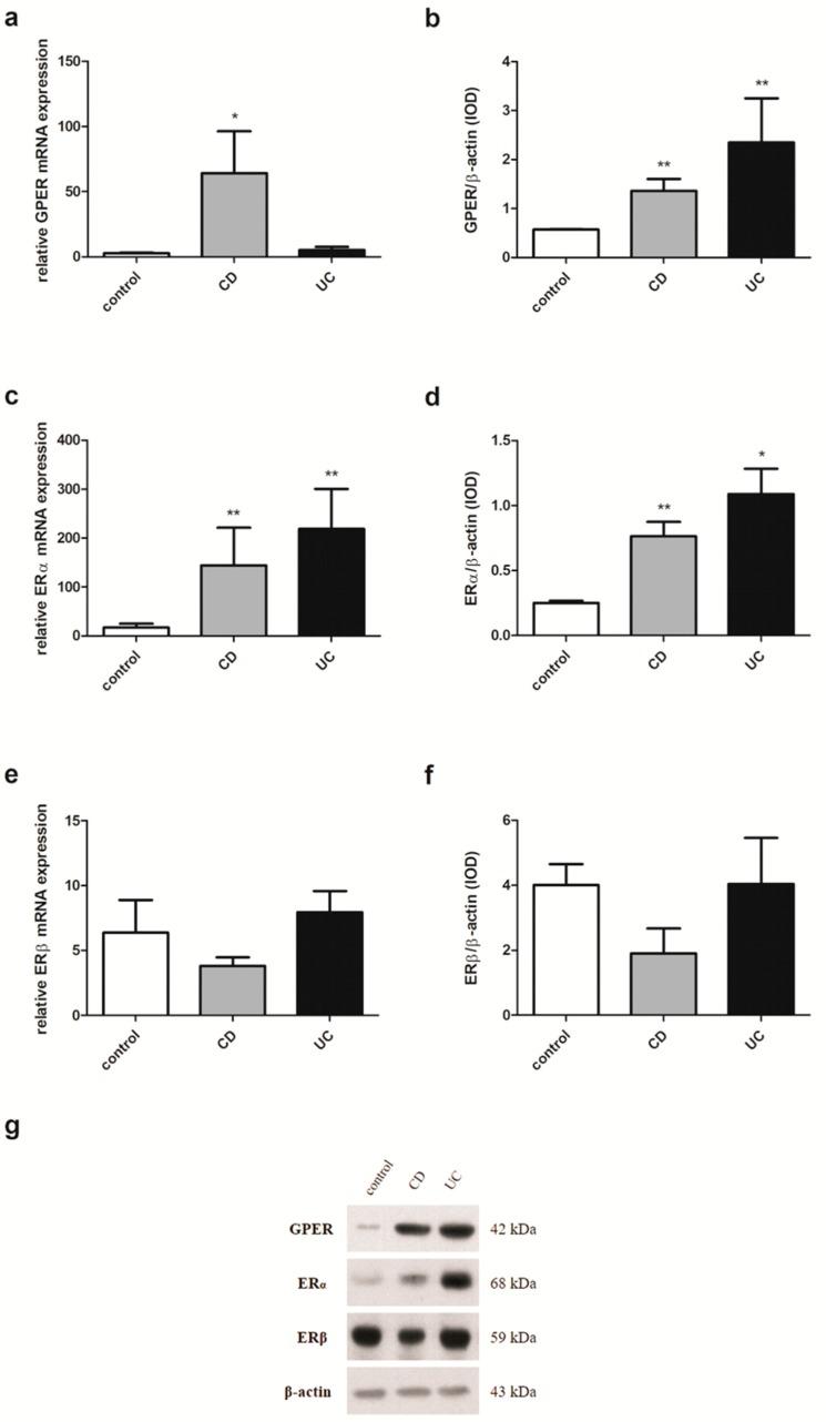 https://cdn.ncbi.nlm.nih.gov/pmc/blobs/038e/6651503/8b888749f663/ijms-20-03175-g004.jpg