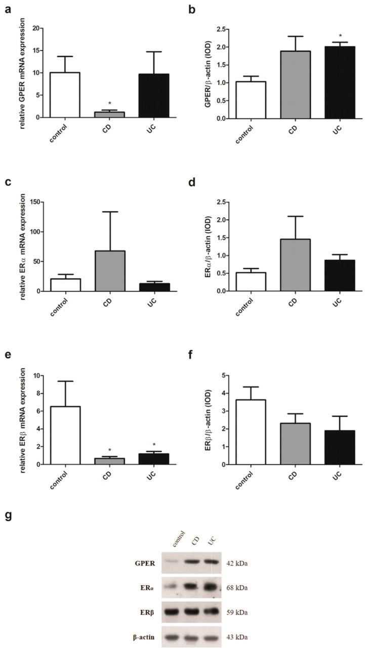 https://cdn.ncbi.nlm.nih.gov/pmc/blobs/038e/6651503/ada97d18469d/ijms-20-03175-g005.jpg
