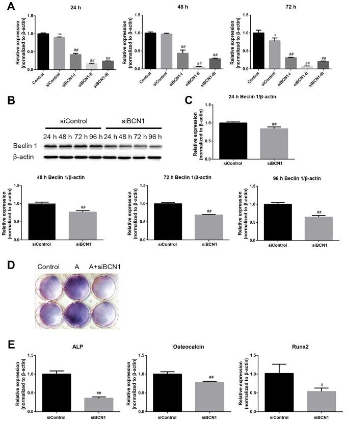 https://cdn.ncbi.nlm.nih.gov/pmc/blobs/0390/5846672/644031d5a7e3/IJMM-41-05-2535-g04.jpg