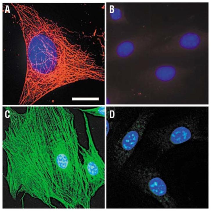 https://cdn.ncbi.nlm.nih.gov/pmc/blobs/0396/5452096/232d6660dd82/materials-06-00483-g004.jpg