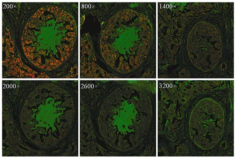 https://cdn.ncbi.nlm.nih.gov/pmc/blobs/0396/5452096/b22c461dd1d8/materials-06-00483-g005.jpg