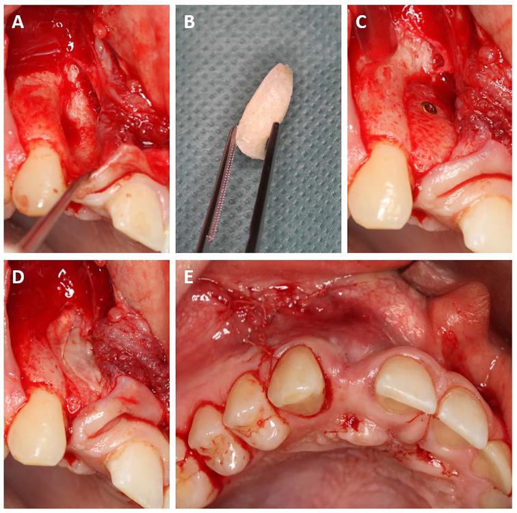 https://cdn.ncbi.nlm.nih.gov/pmc/blobs/0396/8734454/e35ab28dfac2/ASC_55(4)_406-417-f2.jpg