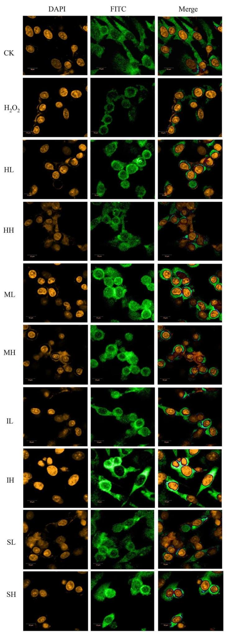 https://cdn.ncbi.nlm.nih.gov/pmc/blobs/0399/5979387/c46d6e198039/ijms-19-01135-g004.jpg