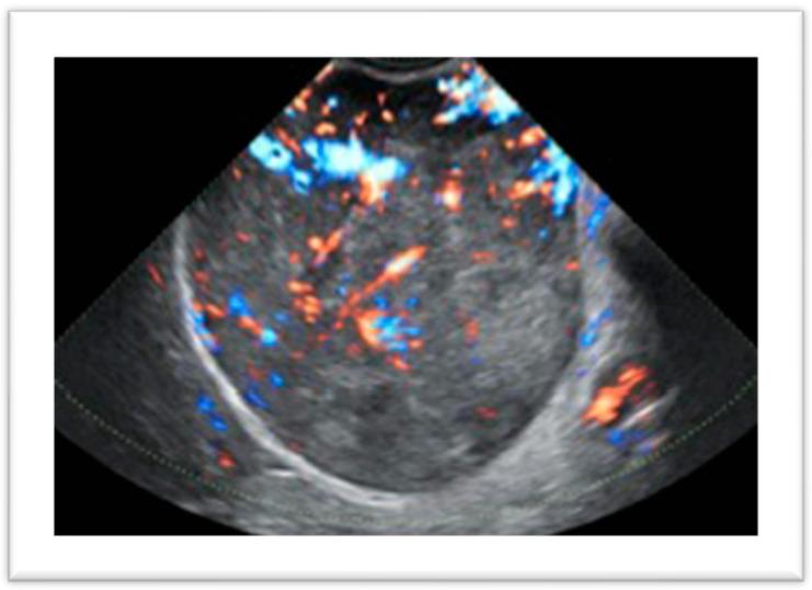 https://cdn.ncbi.nlm.nih.gov/pmc/blobs/039f/11431597/d188e90ed7ee/diagnostics-14-02046-g001.jpg