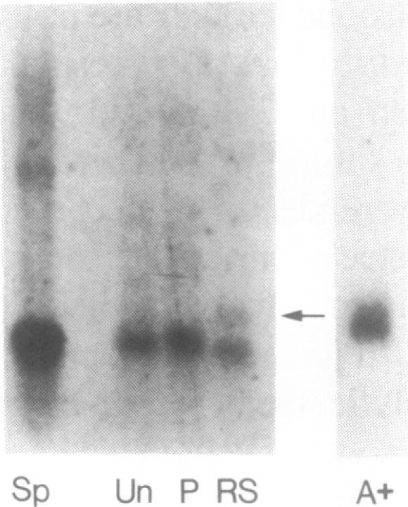 https://cdn.ncbi.nlm.nih.gov/pmc/blobs/03a3/310291/e3ded80697fa/nar00039-0308-a.jpg