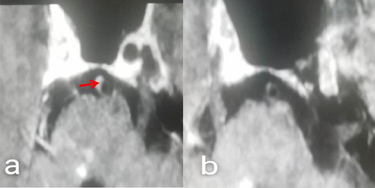 https://cdn.ncbi.nlm.nih.gov/pmc/blobs/03ad/9616278/0f0f9ad3706b/gr3.jpg
