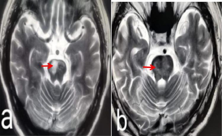 https://cdn.ncbi.nlm.nih.gov/pmc/blobs/03ad/9616278/15b8025c6de4/gr1.jpg