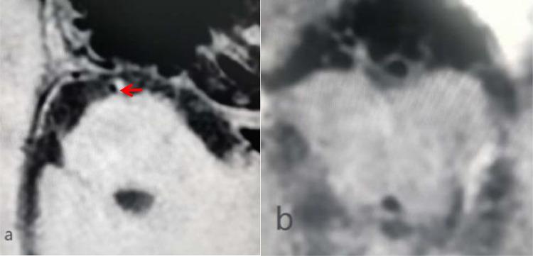 https://cdn.ncbi.nlm.nih.gov/pmc/blobs/03ad/9616278/86099ac155fe/gr2.jpg