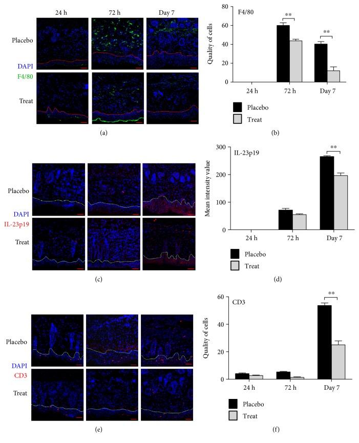 https://cdn.ncbi.nlm.nih.gov/pmc/blobs/03b2/5429961/e581002748d0/MI2017-6541729.006.jpg