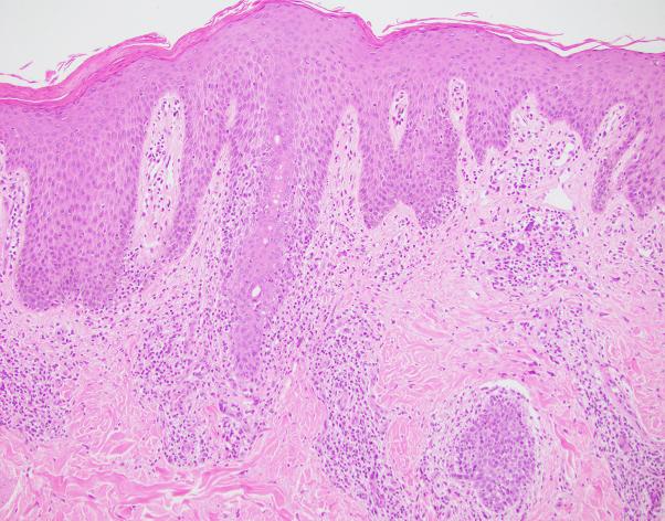 https://cdn.ncbi.nlm.nih.gov/pmc/blobs/03b5/7829113/a3fe39460fb7/gr4.jpg