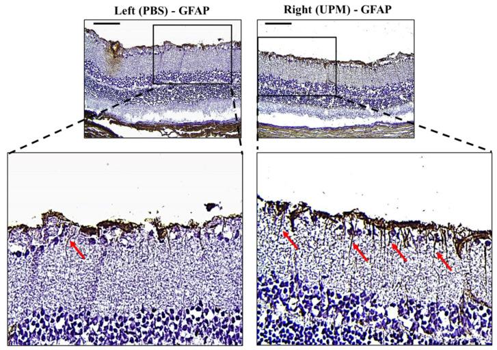 https://cdn.ncbi.nlm.nih.gov/pmc/blobs/03b7/7404123/aabb68f616c4/ijms-21-04976-g009.jpg