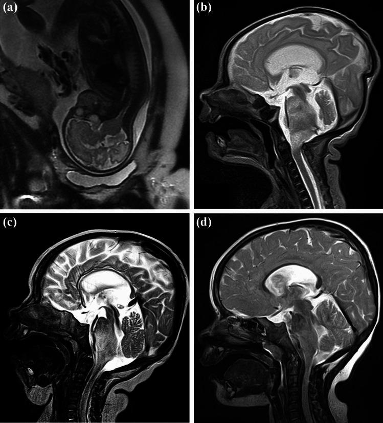 https://cdn.ncbi.nlm.nih.gov/pmc/blobs/03b9/10972984/12af67711106/381_2023_6272_Fig3_HTML.jpg