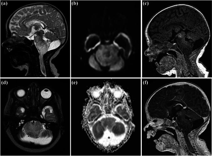 https://cdn.ncbi.nlm.nih.gov/pmc/blobs/03b9/10972984/740086e64330/381_2023_6272_Fig4_HTML.jpg