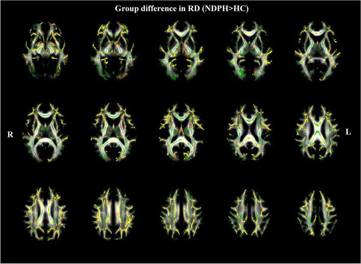 https://cdn.ncbi.nlm.nih.gov/pmc/blobs/03be/10315051/e902b9b654ff/10194_2023_1620_Fig4_HTML.jpg